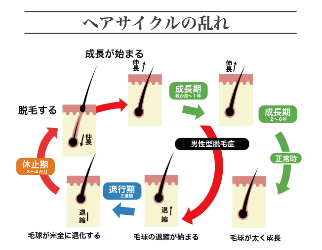 ヘアサイクルの乱れ